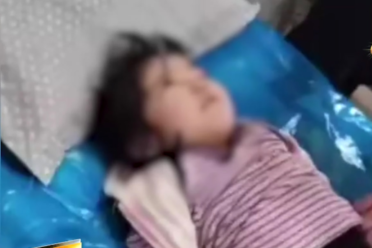 Трёхлетняя девочка воткнула карандаш в глаз в детском саду