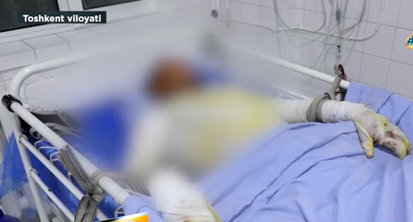 Селфи, которое едва не стало последним: подростка ударило током на крыше вагона